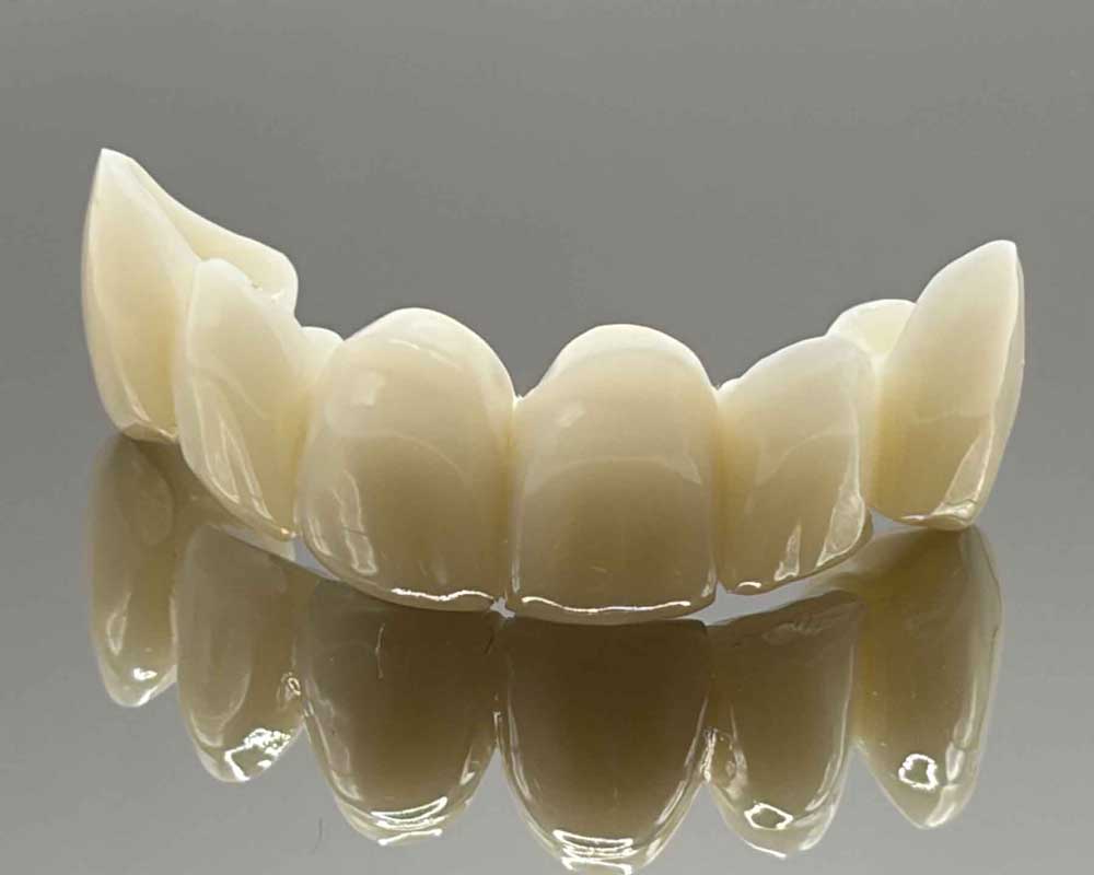 Dental veneers displayed with reflection at Whittier Palm Dental in Montebello, CA